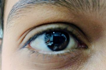 Dr.SZ Zafrey Eye Allergy Specialist in Indore, Eye Allergy, Allergic Pink Eye In Indore, Doctors for Eye Allergy in Indore, Best Eye Allergies Treatment Doctors in Indore, Eye Allergy Treatments in Indore, Doctors For Allergy in Indore