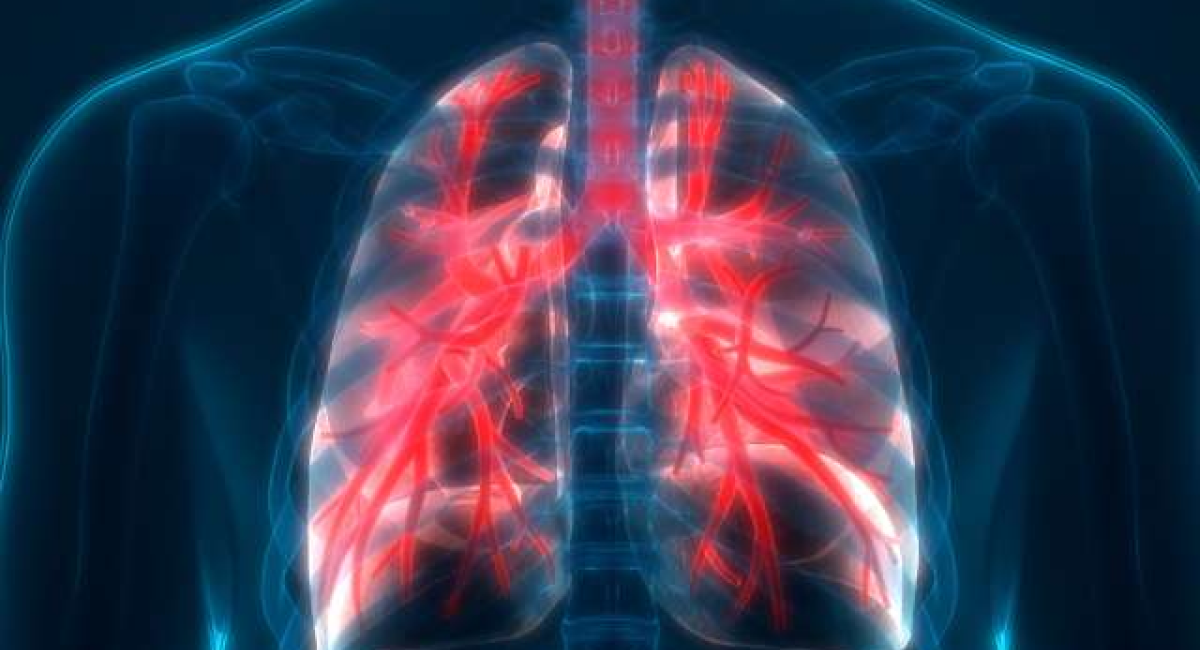 Interstitial Lung Disease (ILD) – Lung Disease Treatment in Indore